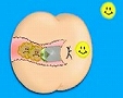 dumpalinkcomtrygladeplugup.jpg
